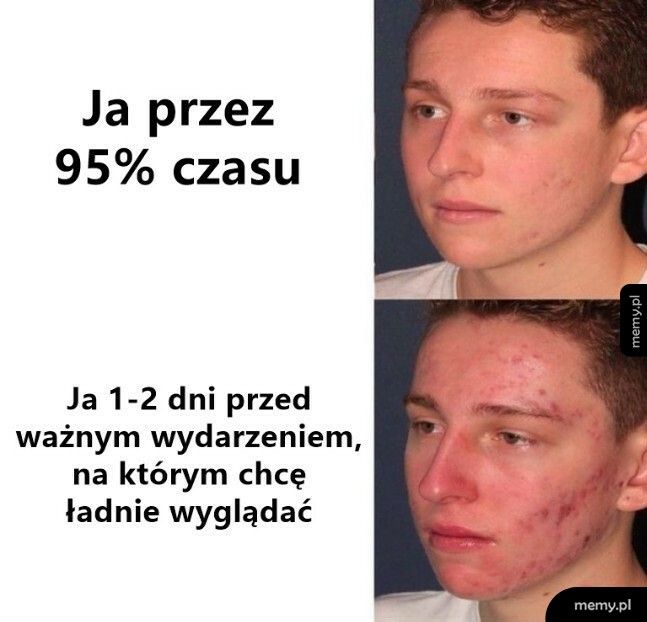 Przykryje się korektorem