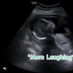 USG śmiejącej się kobiety w ciąży