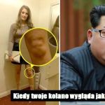 Kolano jak Kim